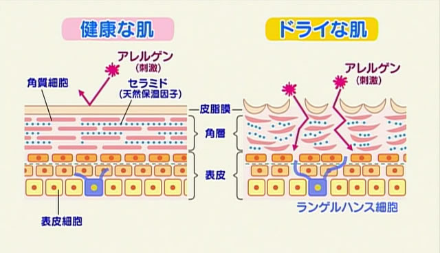 「健康な肌」と「ドライな肌」の違い