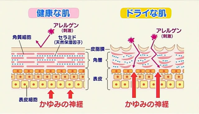 赤ちゃんの冬の肌ケア