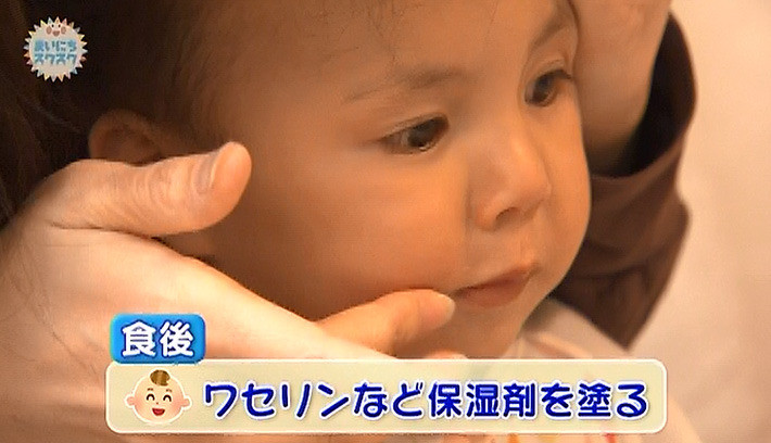 乳幼児の肌を守ろう 1 口まわりのスキンケア 子育てに役立つ情報満載 すくコム Nhkエデュケーショナル