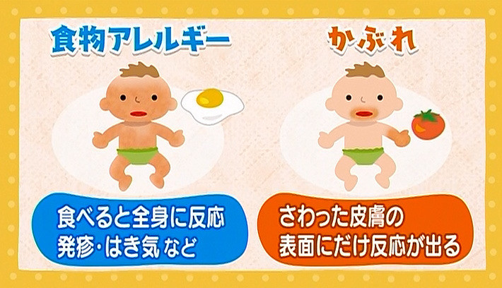 うちの子 食物アレルギー 子育てに役立つ情報満載 すくコム Nhkエデュケーショナル