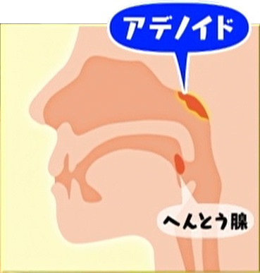 鼻づまりを楽にしてあげたいのにお世話を嫌がる どうすればいい 子育てに役立つ情報満載 すくコム Nhkエデュケーショナル