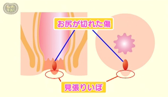 どんな状態のウンチが健康なの 子育てに役立つ情報満載 すくコム Nhkエデュケーショナル