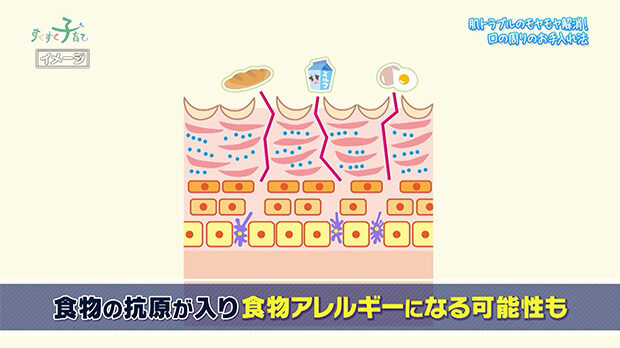 食物が抗原に入り食物アレルギーになる可能性も