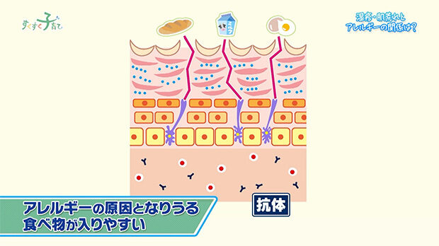 荒れた皮膚はアレルギーの原因となりうる食べ物が入りやすい