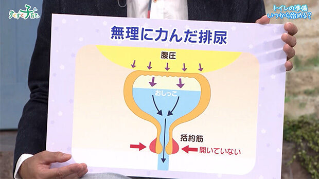 無理に力んだ排尿